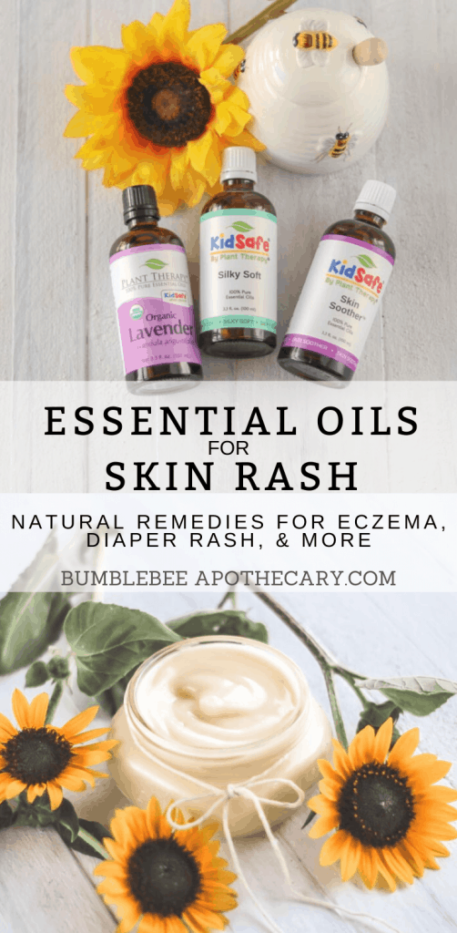 This is the best list of essential oils for skin rash. There are links to where I can buy them, too. I needed this! #essentialoil #eczema #diaperrash #skinrash #remedy