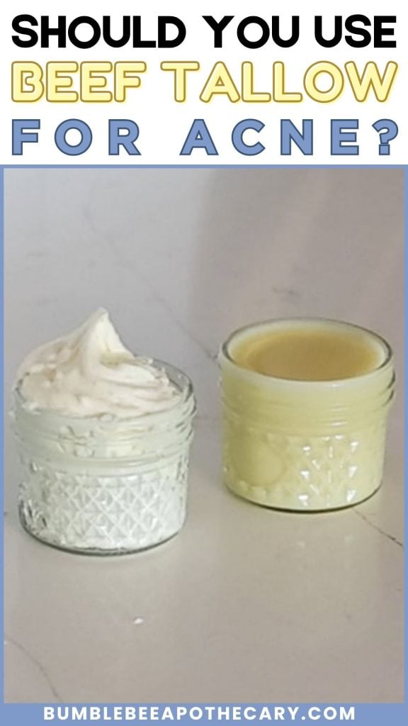 Is Tallow Good for Acne? A Certified GAPS Coach's Honest Take